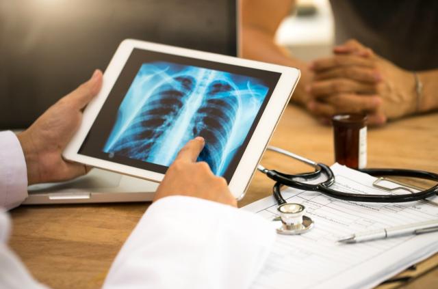 Un médecin démontre un tache sur un poumon